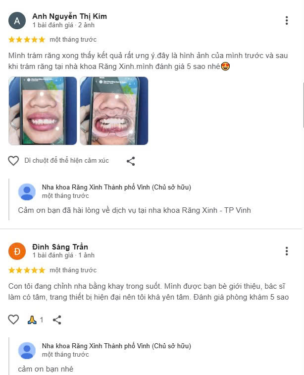 Nha khoa Răng Xinh - Địa chỉ điều trị răng miệng toàn diện tại Nghệ An nhiều khách hàng đã tin tưởng lựa chọn Răng Xinh làm điểm đến cải thiện nụ cười và nhận được kết quả mãn nguyện
