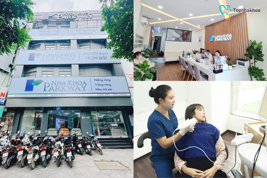 Cập nhật bảng giá niềng răng Hà Nội mới và chính xác nhất Công nghệ và dịch vụ điều trị cũng như chăm sóc cũng ảnh hưởng tới mức giá khi khách hàng niềng răng