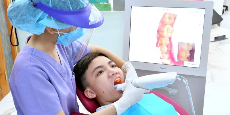 Thời gian niềng răng ở tuổi 30 tùy thuộc vào mức độ lệch lạc và phương pháp điều trị