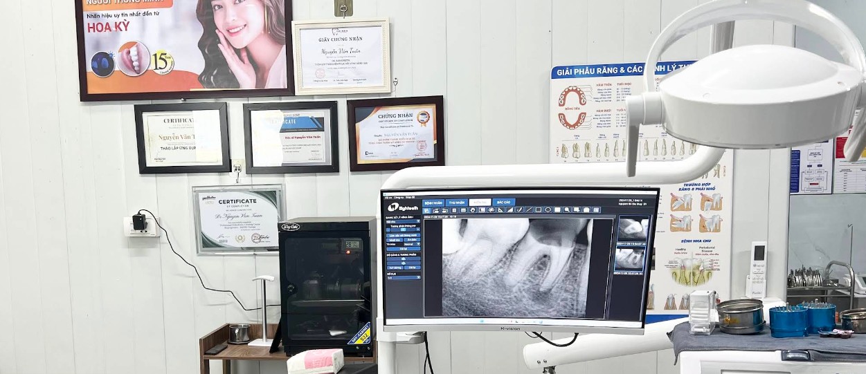 Top 5 nha khoa Ba Vì uy tín và chất lượng nhất hiện nay Cơ sở có hệ thống máy móc và thiết bị hiện đại, đồng bộ