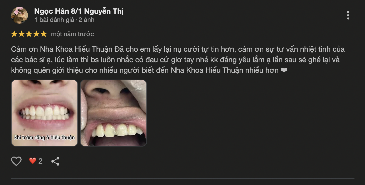 Nha khoa Hiếu Thuận nơi gửi niềm tin trao nụ cười đánh giá của khách hàng