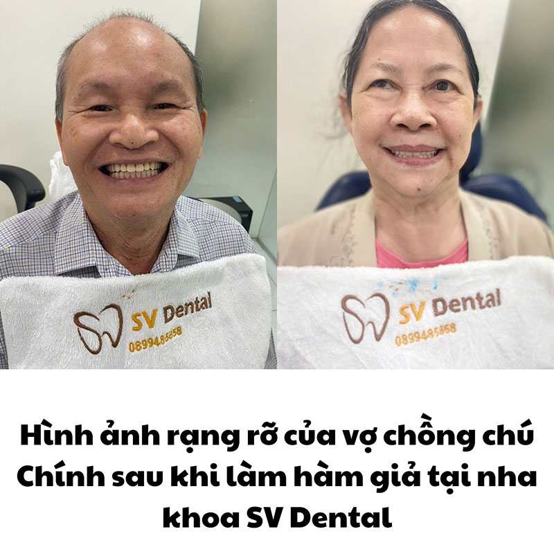 Nha khoa SV Dental - Địa chỉ nha khoa chất lượng tại Quận 3 TPHCM Vợ chồng chú Chính đã có một hàm răng mới chắc chắn và đẹp tự nhiên sau điều trị tại nha khoa