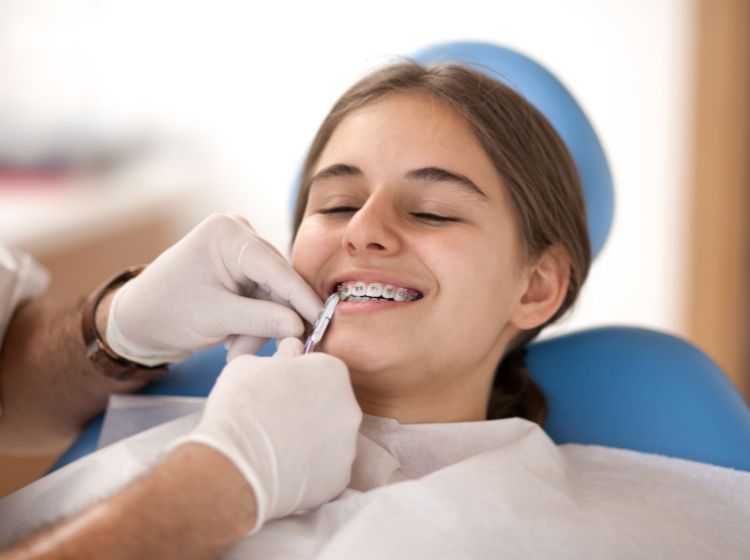 Tất tần tật những điều bạn cần biết về niềng răng 1 hàm Niềng răng 1 hàm là phương pháp được nhiều người quan tâm