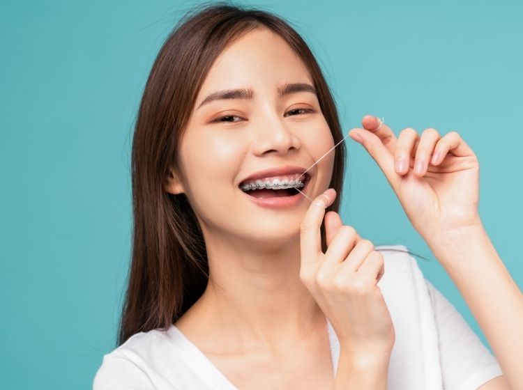 Niềng răng hô cải thiện thẩm mỹ cho người bệnh