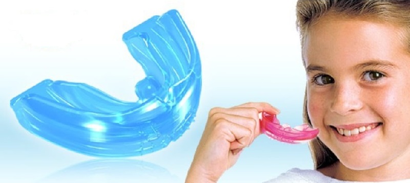 Trainer tạo lực nhẹ lên răng để hướng răng về đúng vị trí
