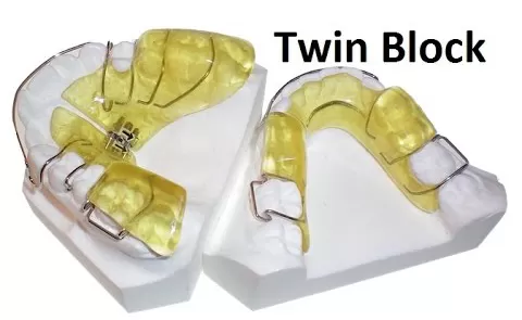 Twin Block thường được sử dụng trong trường hợp răng hô (khớp cắn sâu)