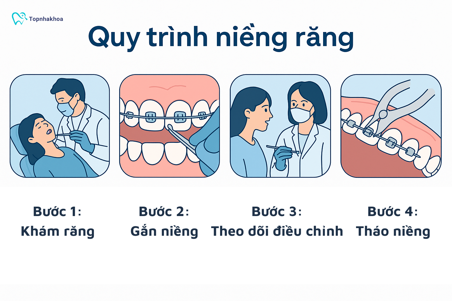 Quy trình niềng răng là yếu tố quyết định lớn đến hiệu quả và thời gian chỉnh nha, giúp răng di chuyển đúng hướng và đạt khớp cắn chuẩn