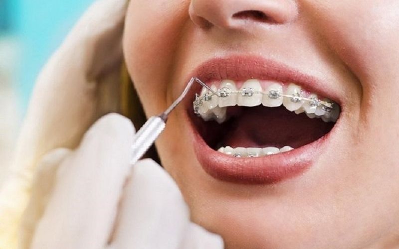 Thường xuyên thăm khám để kiểm tra tình trạng răng miệng