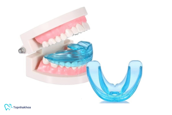 Hàm chỉnh răng trainer là khí cụ tiền chỉnh nha được thiết kế đặc biệt cho trẻ em trong giai đoạn răng và xương hàm còn phát triển