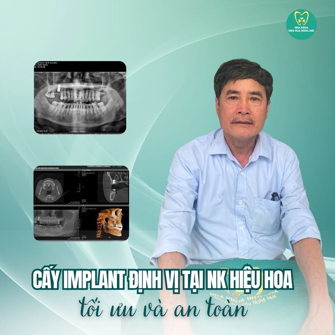 Nha khoa Hiệu Hoa chăm sóc răng miệng uy tín và an toàn Sau điều trị người bệnh có hàm răng mới chắc chắn đẹp tự nhiên