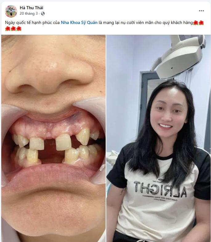 4 Nha khoa ở đường Nguyễn Văn Cừ quận Long Biên được đánh giá cao Nhận xét về Sỹ Quân