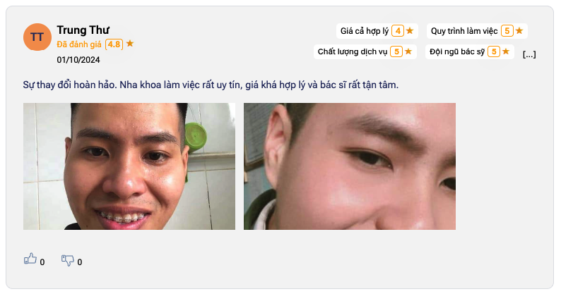 Gợi ý các nha khoa ở phường Nhiêu Lộc được đánh giá cao Nhận xét về Paris