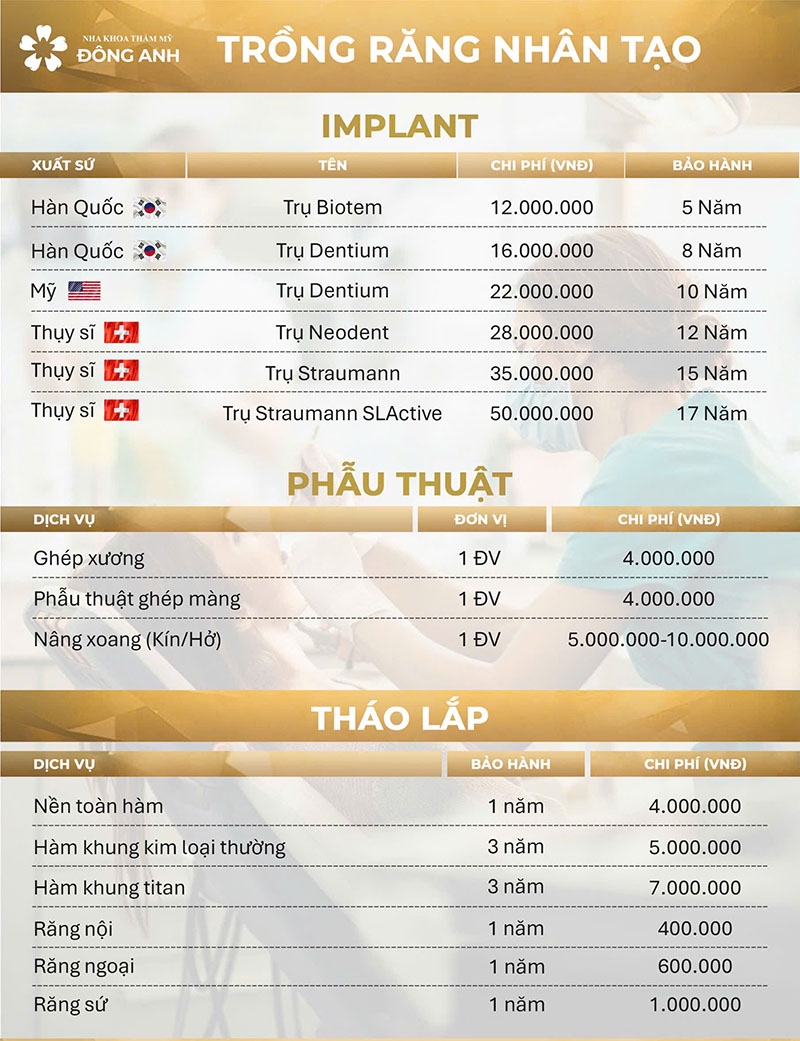 Bảng giá dịch vụ trồng răng - cấy ghép implant