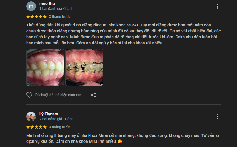 Nhận xét về Mirai