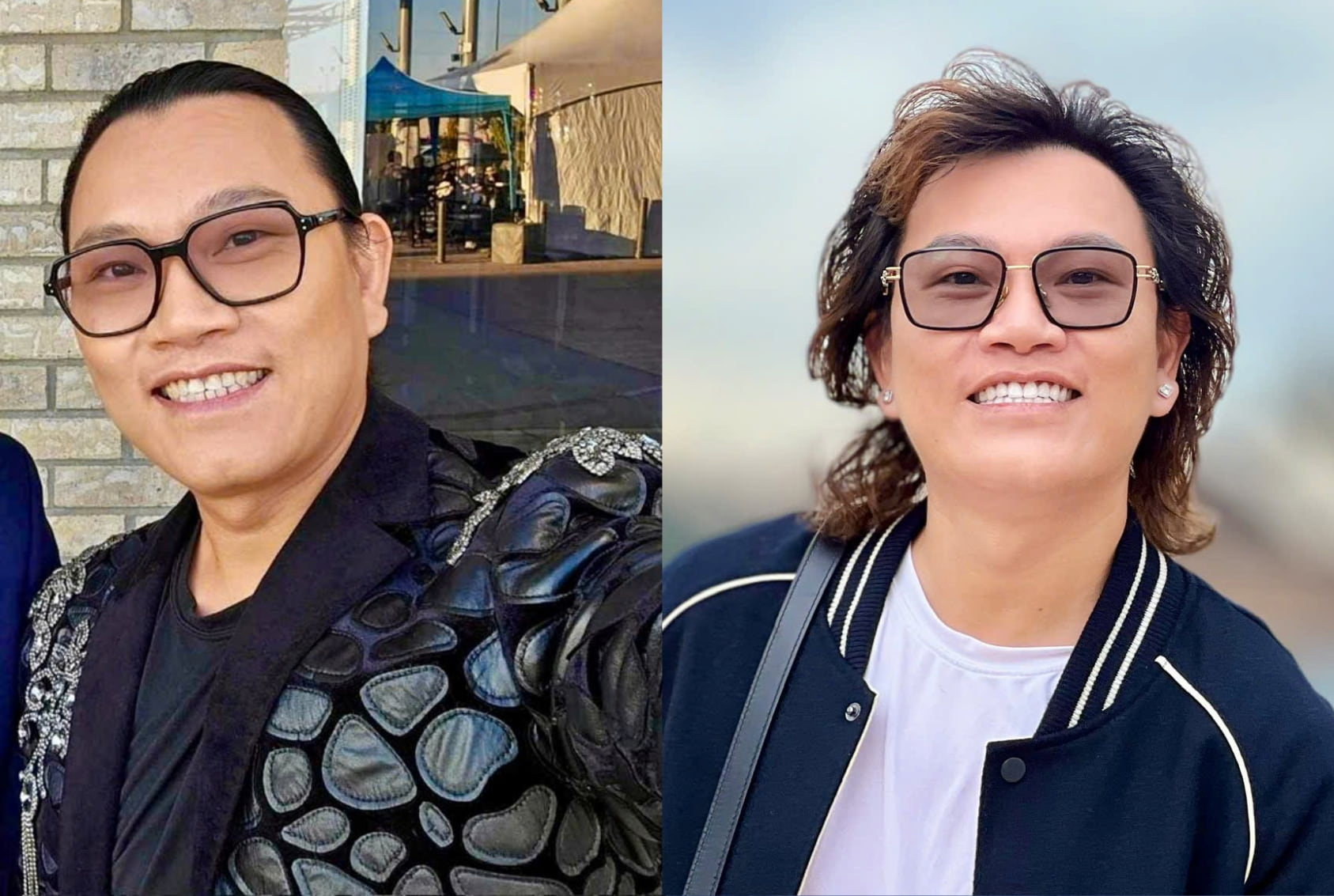 Anh khách sở hữu hàm răng mới trắng sáng đều đẹp như ý tại nha khoa  Thu Lan