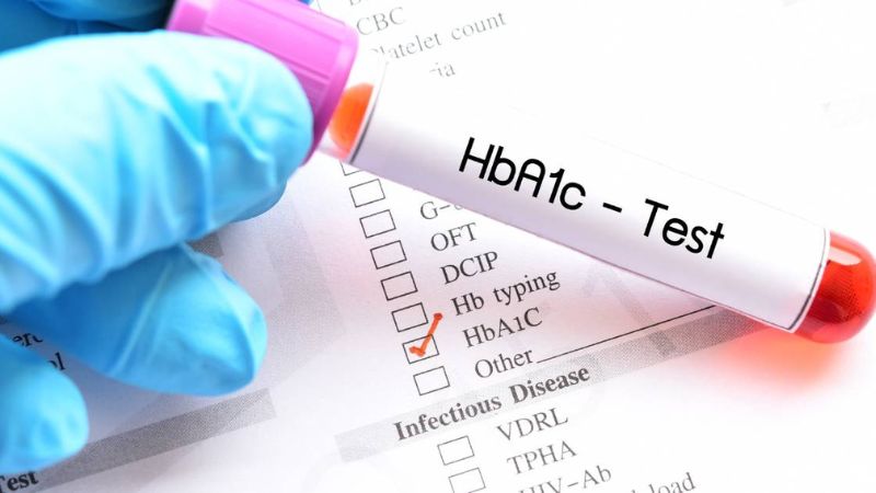 Bị tiểu đường có nhổ răng được không? Cách chăm sóc an toàn sau nhổ răng Người có chỉ số HbA1c cao không đủ điều kiện nhổ răng