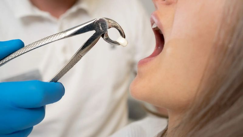Đầu năm nhổ răng có sao không? Lưu ý để nhổ răng an toàn Đầu năm nhổ răng có sao không? Nhổ răng đầu năm sẽ phạm vào điều kiêng kỵ theo quan niệm dân gian