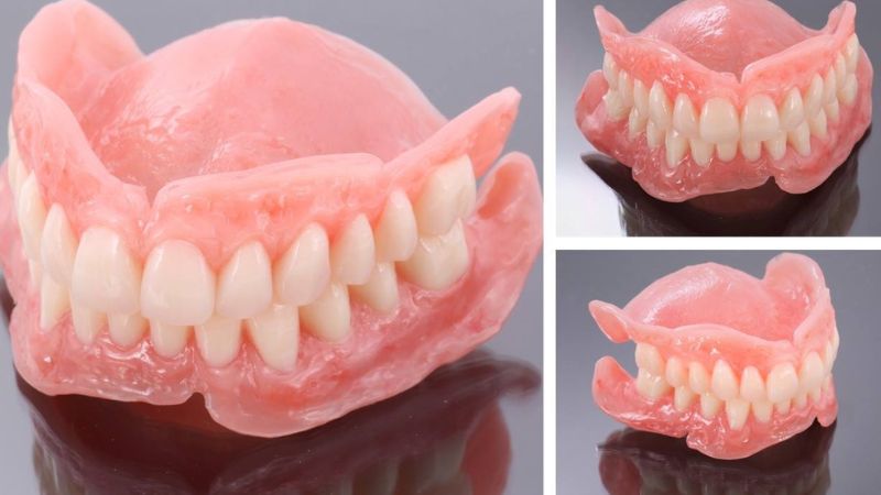 Nhổ răng chết tủy có đau không? Bao lâu thì hết đau? Dùng hàm tháo lắp để trồng răng là phương pháp cần thiết thực hiện giúp đảm bảo chức năng ăn nhai