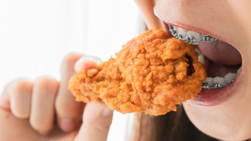 Niềng răng có ăn uống bình thường được không? Thực đơn "chuẩn" Sau 1 tháng bạn có thể ăn uống bình thường nhưng tránh đồ dai, cứng trong thực đơn