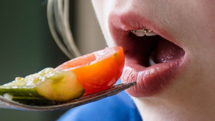 Giải đáp nhanh: Niềng răng có ăn uống bình thường được không?