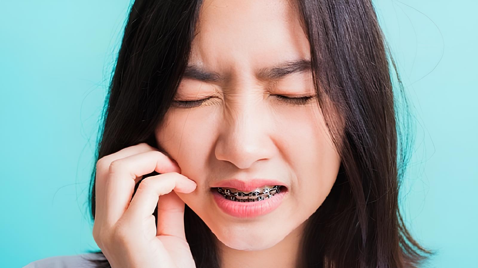 Niềng răng có đi máy bay được không? 3 Lưu ý quan trọng Thay đổi áp suất trên máy bay có thể khiến răng đang niềng bị ê nhẹ