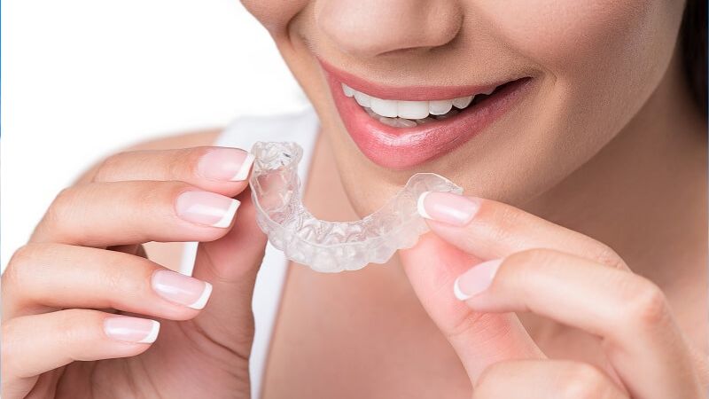 Niềng răng có đi máy bay được không? 3 Lưu ý quan trọng Nếu niềng răng bằng Invisalign, khay trong dễ bị khô và bí khi bay trong nhiều giờ
