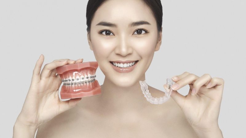 Giải đáp: Niềng răng silicon cho người lớn có hiệu quả không? Niềng răng trong suốt là phương pháp chỉnh nha tối ưu cho người lớn