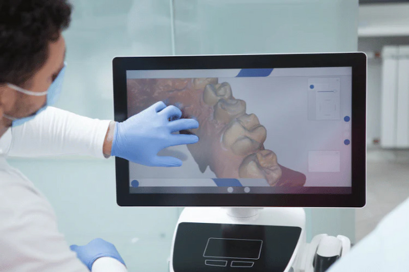 Niềng răng trong suốt có hiệu quả không? Giải đáp từ chuyên gia Công nghệ quét dấu răng và phần mềm mô phỏng 3D quá trình chỉnh nha