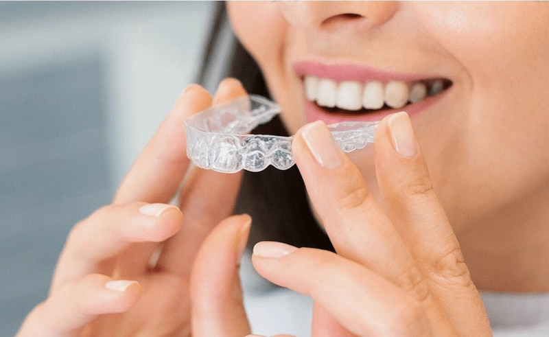 Niềng răng trong suốt Leetray và thông tin nhất định phải biết Chỉnh nha trong suốt Leetray có tính thẩm mỹ cao, khay thiết kế riêng tháo lắp linh hoạt