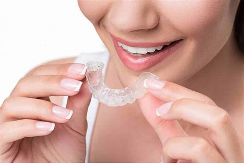 40 tuổi có niềng răng được không và những lưu ý phải biết Invisalign phù hợp với người 40 tuổi nhờ tính thẩm mỹ cao, tháo lắp linh hoạt