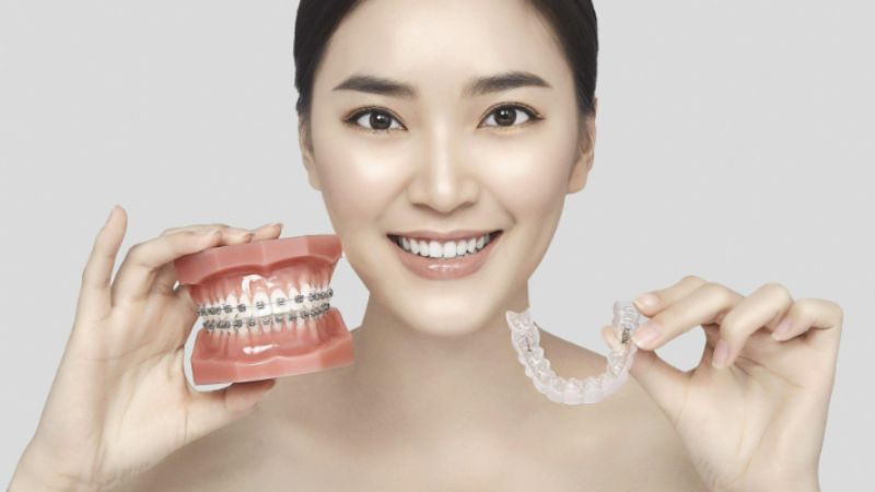 Bọc răng sứ có niềng răng được không? Lưu ý "vàng" từ chuyên gia Bọc răng sứ có niềng răng được không? Bọc răng sứ đủ điều kiện niềng răng nếu cùi răng thật còn chắc khỏe