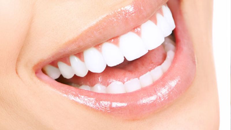 Bọc răng sứ có tẩy trắng được không? Giải pháp làm sáng hiệu quả Bọc răng sứ có tẩy trắng được không? Răng sứ không có men răng nên không hiệu quả khi sử dụng thuốc tẩy trắng