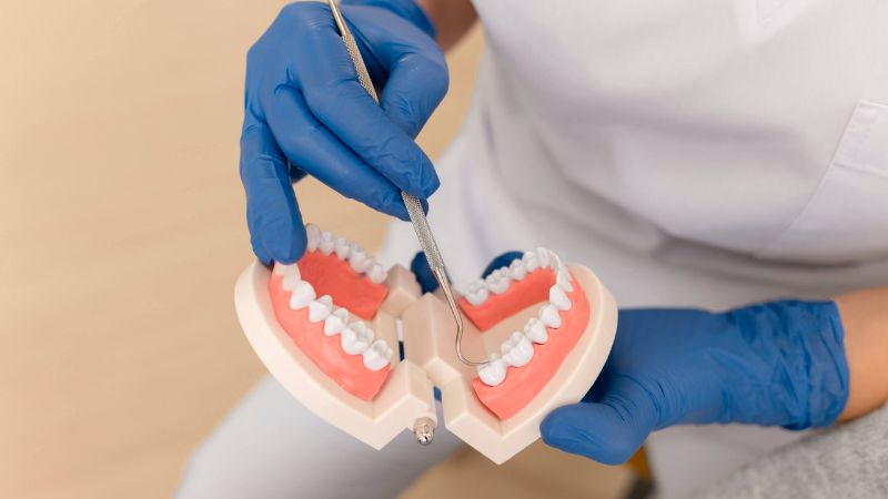 Chi phí bọc răng sứ ở Nhật là bao nhiêu? So sánh với Việt Nam Chi phí bọc răng sứ ở Nhật ở mức cao so với nhiều quốc gia trong khu vực