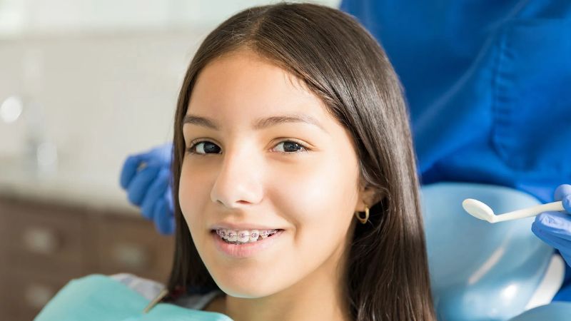 Hóp thái dương khi niềng răng: Nguyên nhân và cách cải thiện Hóp thái dương khi niềng răng là do hiệu ứng gương mặt gọn lại
