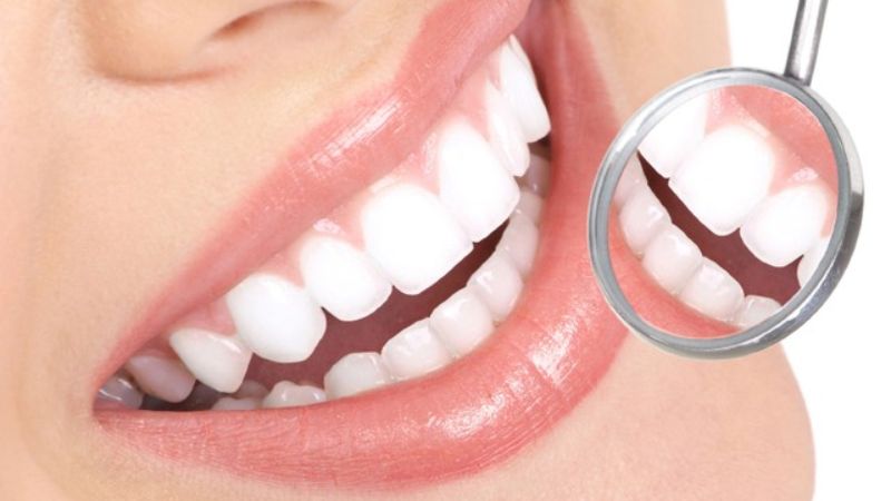 Nên tẩy trắng răng hay bọc sứ? Lời khuyên từ bác sĩ nha khoa Đừng vội vàng tẩy trắng răng hay bọc sứ chỉ vì chạy theo trào lưu thẩm mỹ