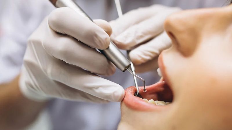 Nhổ răng để niềng có nguy hiểm không? Trường hợp nào an toàn Nhổ răng để niềng có nguy hiểm không?Nhổ răng để niềng không gây nguy hiểm