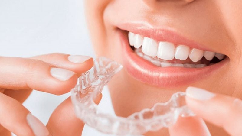 Niềng răng có ảnh hưởng gì không? Giải đáp chi tiết từ bác sĩ Để tránh bị ảnh hưởng khi niềng răng, bạn cần đeo hàm duy trì đủ thời gian