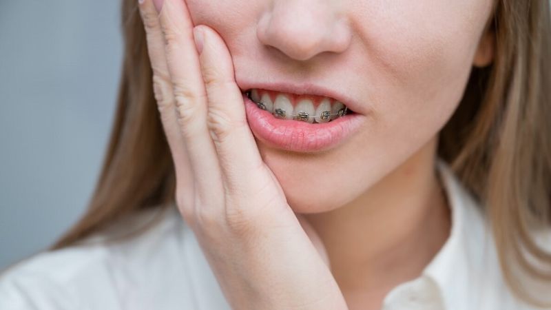 Niềng răng có tháo ra được không? Trường hợp được phép tháo niềng Bạn không được phép tháo niềng chỉ vì muốn loại bỏ cảm giác đau