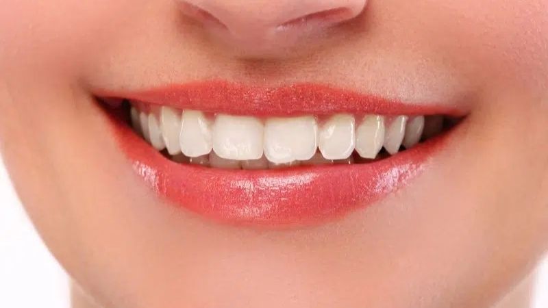 Niềng răng xong bị hô nguyên nhân do đâu? Cách cải thiện Nguyên nhân niềng răng xong bị hô có thể do xương hàm tiếp tục phát triển ở người trẻ