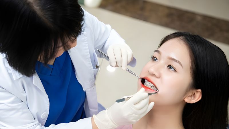 Quy trình niềng răng thưa: 6 bước chuẩn y khoa hiệu quả Quy trình niềng răng được thực hiện qua nhiều bước khác nhau