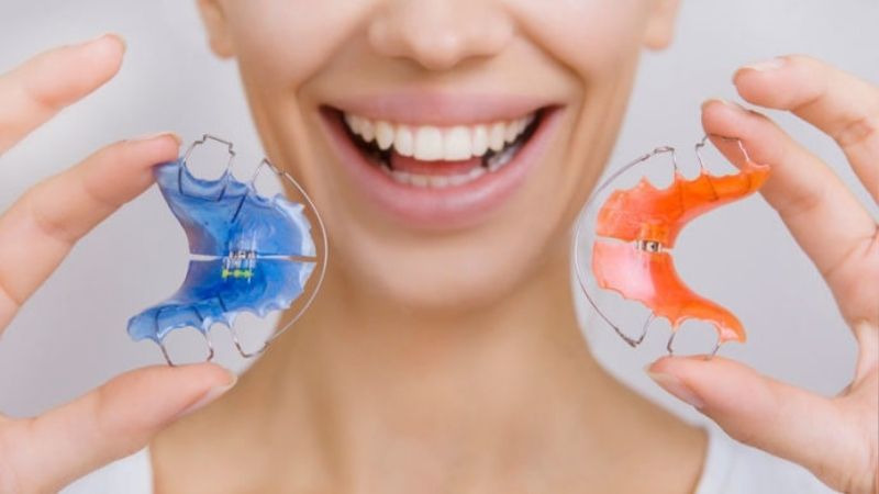 Răng bị thưa sau khi niềng: Nguyên nhân và giải pháp khắc phục Đeo hàm duy trì để phòng ngừa răng bị thưa trở lại sau niềng