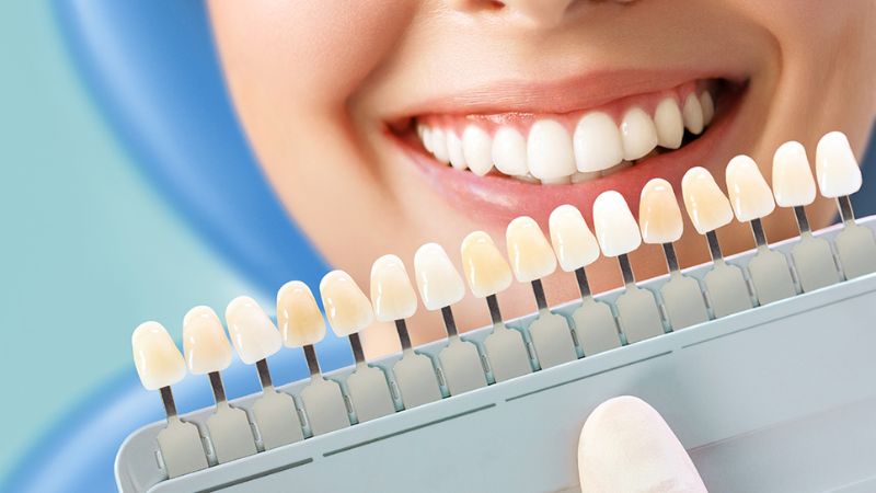 Răng sứ trắng đục là gì? Mức độ ảnh hưởng và cách khắc phục Răng sứ trắng đục không phải là lỗi kỹ thuật