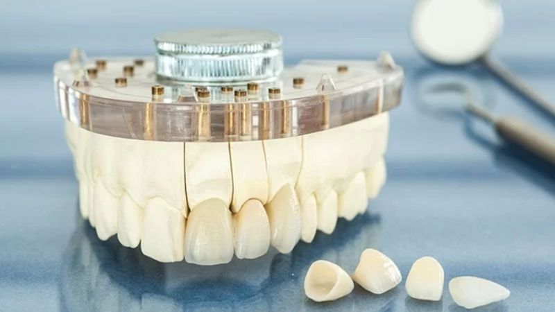 Răng sứ trắng đục là gì? Mức độ ảnh hưởng và cách khắc phục Trường hợp răng sứ có màu trắng đục, đánh mất thẩm mỹ cần làm lại