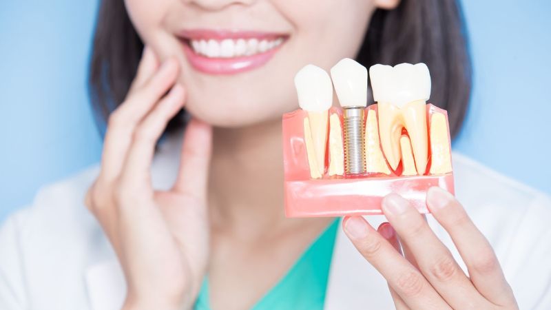 Review trồng răng Implant: Kinh nghiệm thực tế từ khách hàng và nha sĩ Phục hình răng đã mất bằng Implant đạt hiệu quả tốt khi có phác đồ điều trị đúng