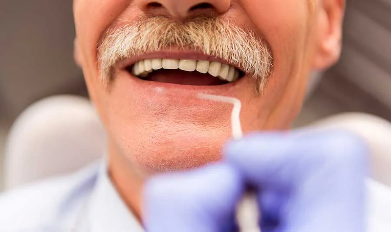 Giải đáp trồng răng Implant cho người cao tuổi được không? Trồng răng Implant cho người cao tuổi cần đảm bảo xương hàm đủ mật độ