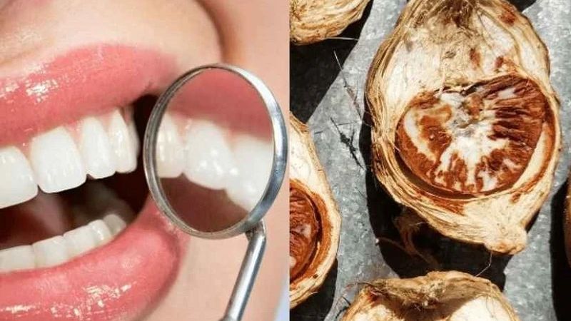 Hướng dẫn cách làm hạt cau ngâm rượu chữa đau răng tại nhà Khi sử dụng rượu cau để giảm đau răng chỉ nên chấm một lượng rất nhỏ lên vùng răng đau