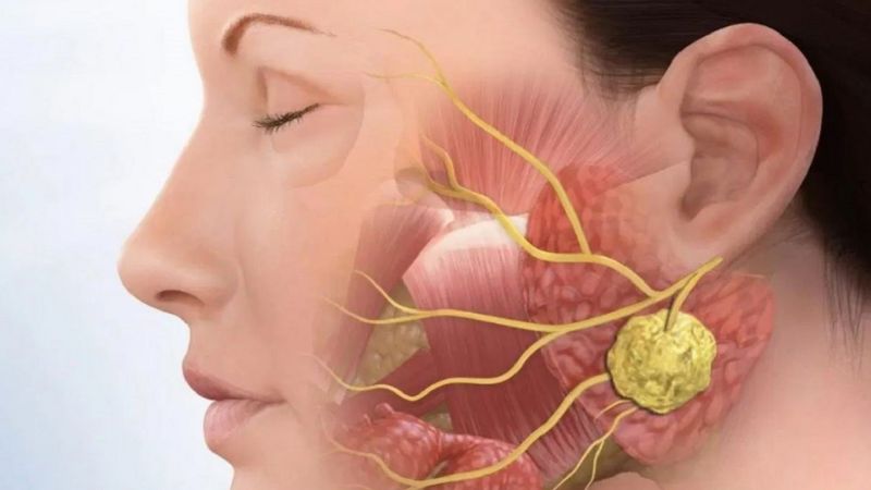 Đau răng đau đầu là gì? Có nguy hiểm không? Đau răng gây đau đầu có liên quan đến khớp thái dương hàm thì cần điều chỉnh khớp cắn