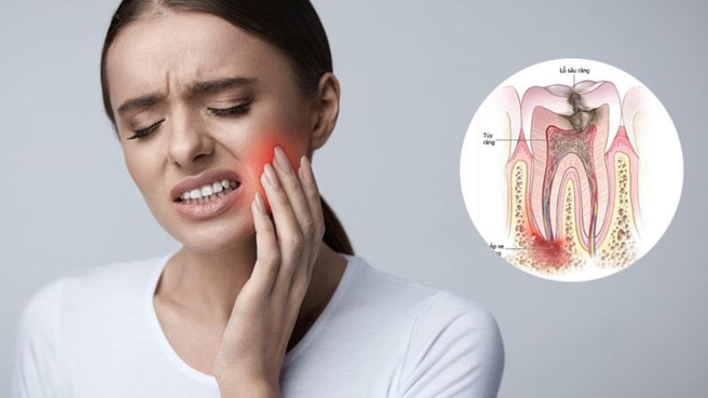 Kháng sinh đau răng có thật sự cần thiết không? Khi nào nên dùng? Nếu tình trạng đau răng tái đi tái lại nhiều lần thì nên thăm khám bác sĩ