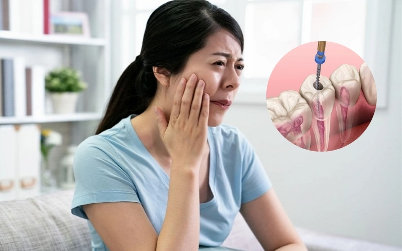 Lấy chỉ máu răng có đau không? Yếu tố ảnh hưởng mức độ đau Người bệnh chỉ cảm giác ê nhẹ sau khi lấy chỉ máu răng