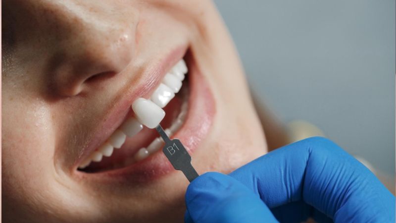 Tháo răng sứ có đau không? Có ảnh hưởng đến răng thật không? Tháo răng sứ không gây đau với trường hợp răng nướu khỏe mạnh, không sưng viêm